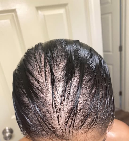 Format diversity chart